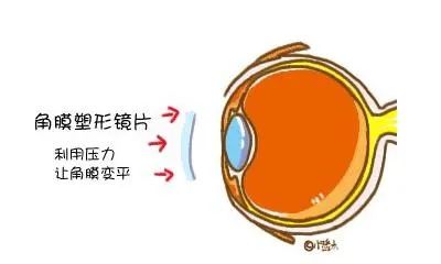 进出口眼镜报关若何归类？